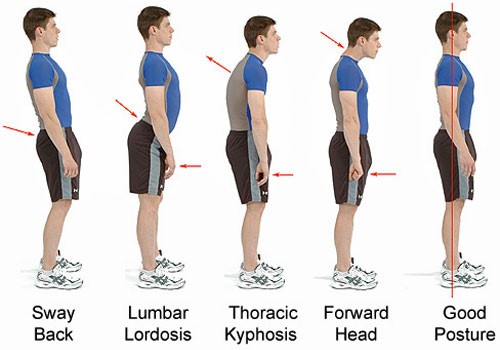 Why is Postural Alignment Important? - Kingsway Health By The Lake ...